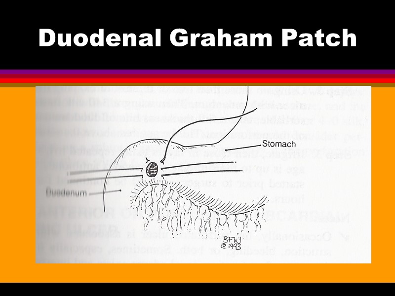 Duodenal Graham Patch